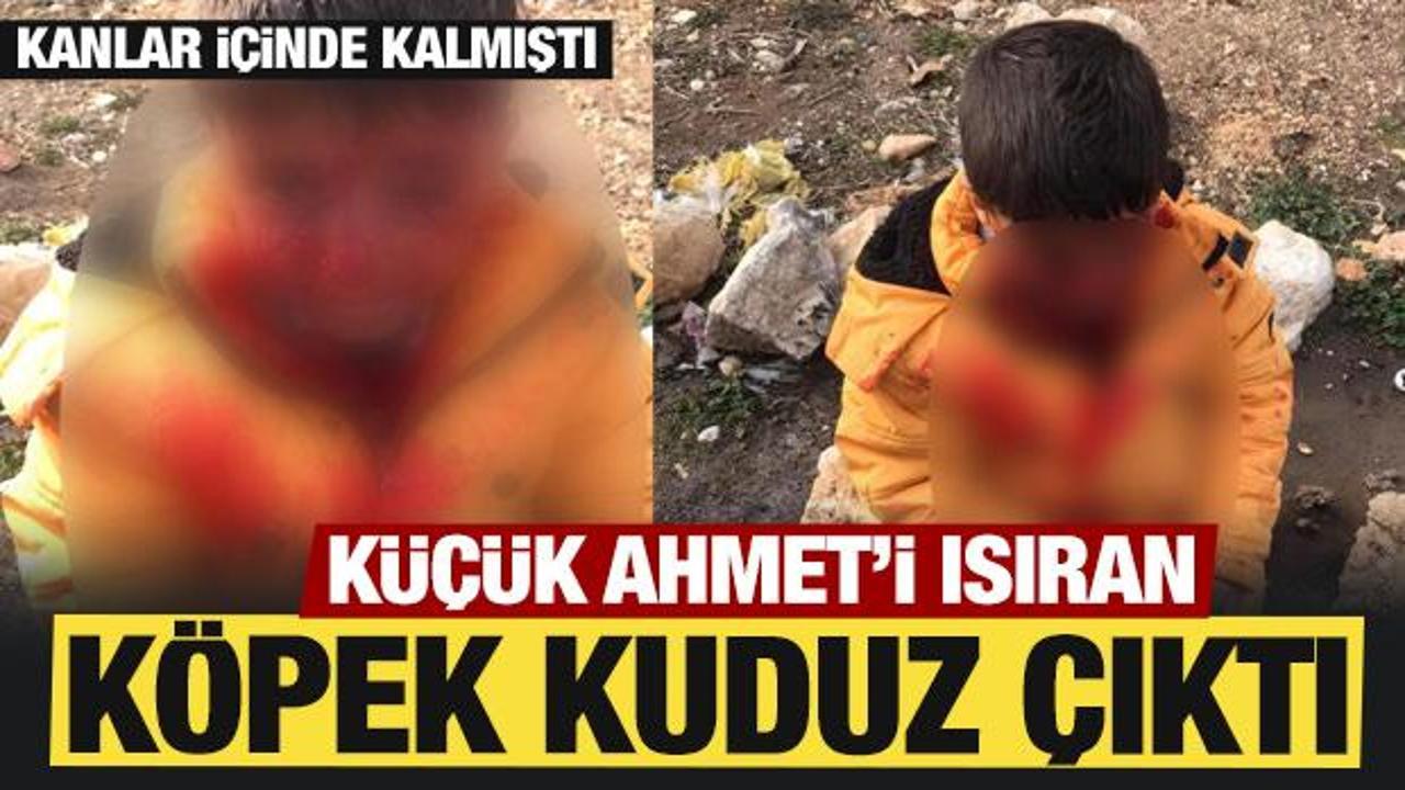 Adıyaman'da Kuduz Köpek Saldırısı: Küçük Ahmet Hastaneye Sevk Edildi