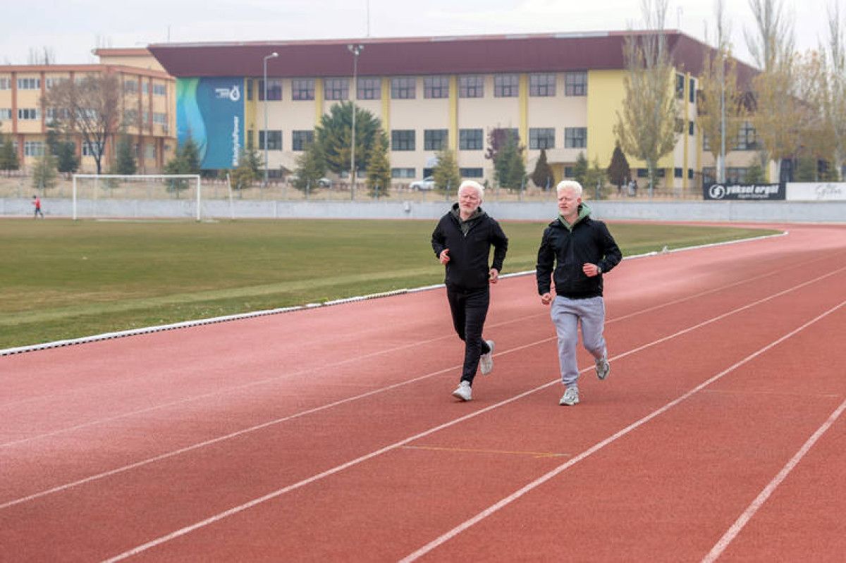 Albinizmli üniversite öğrencileri Muhammet ve Yusuf'un dayanışma hikâyesi