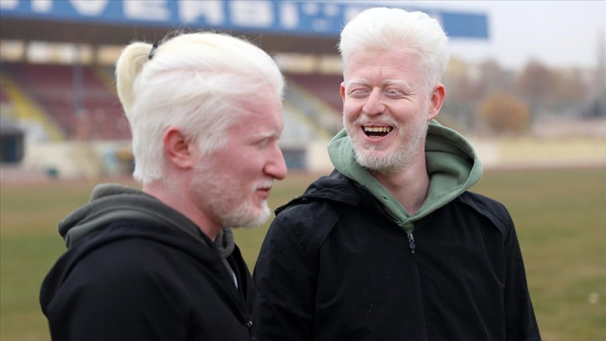 Albinizmli üniversite öğrencileri Muhammet ve Yusuf'un dayanışma hikâyesi