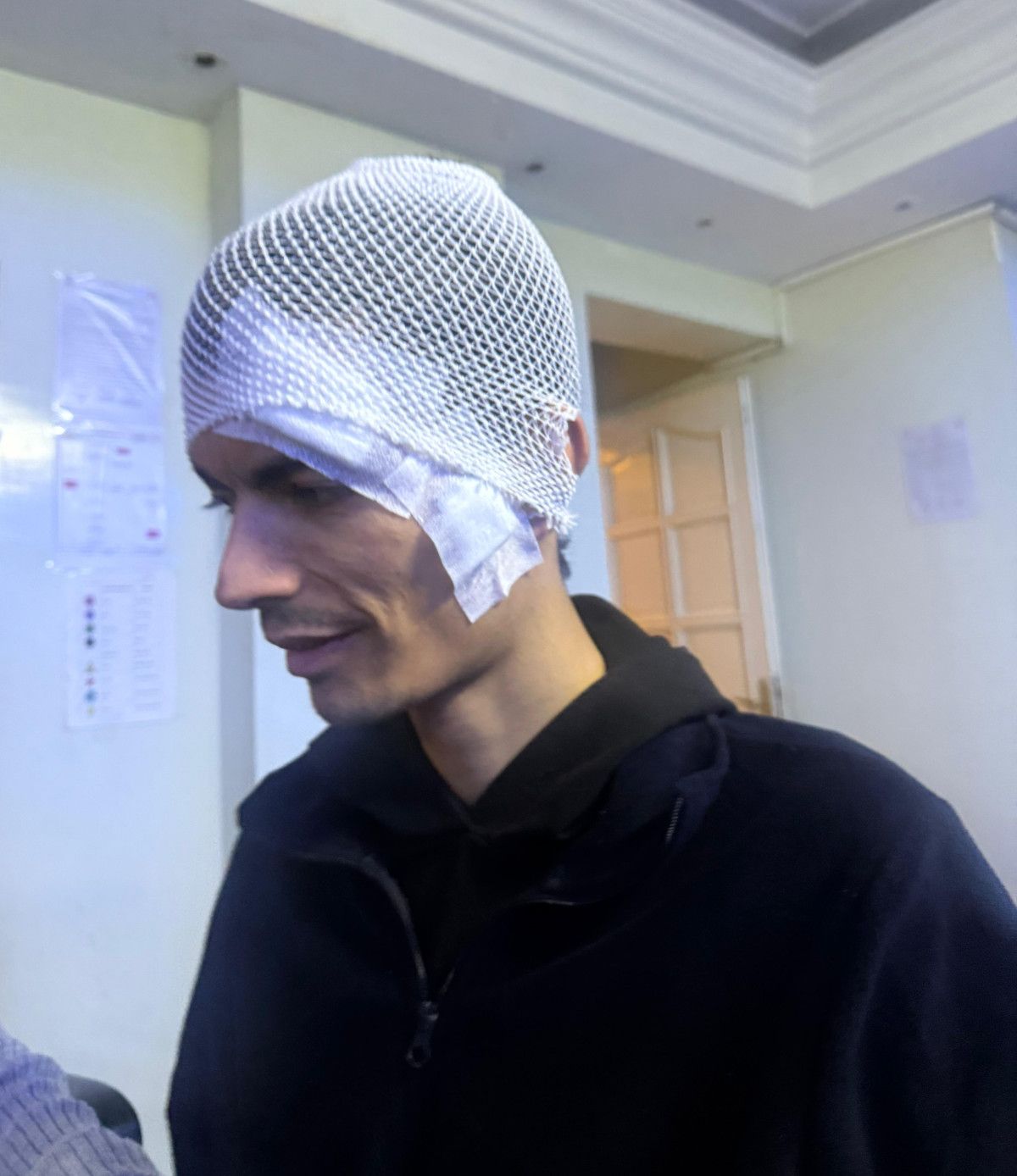 Gaziantep’te engelli bakım merkezinde şiddet: Gencin başına 6 dikiş atıldı