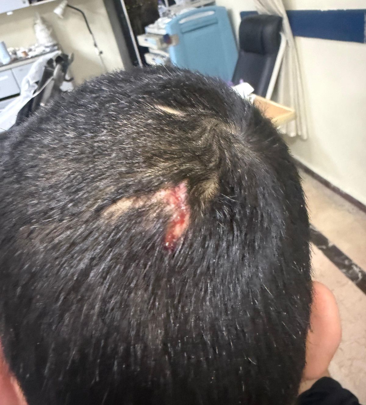 Gaziantep’te engelli bakım merkezinde şiddet: Gencin başına 6 dikiş atıldı