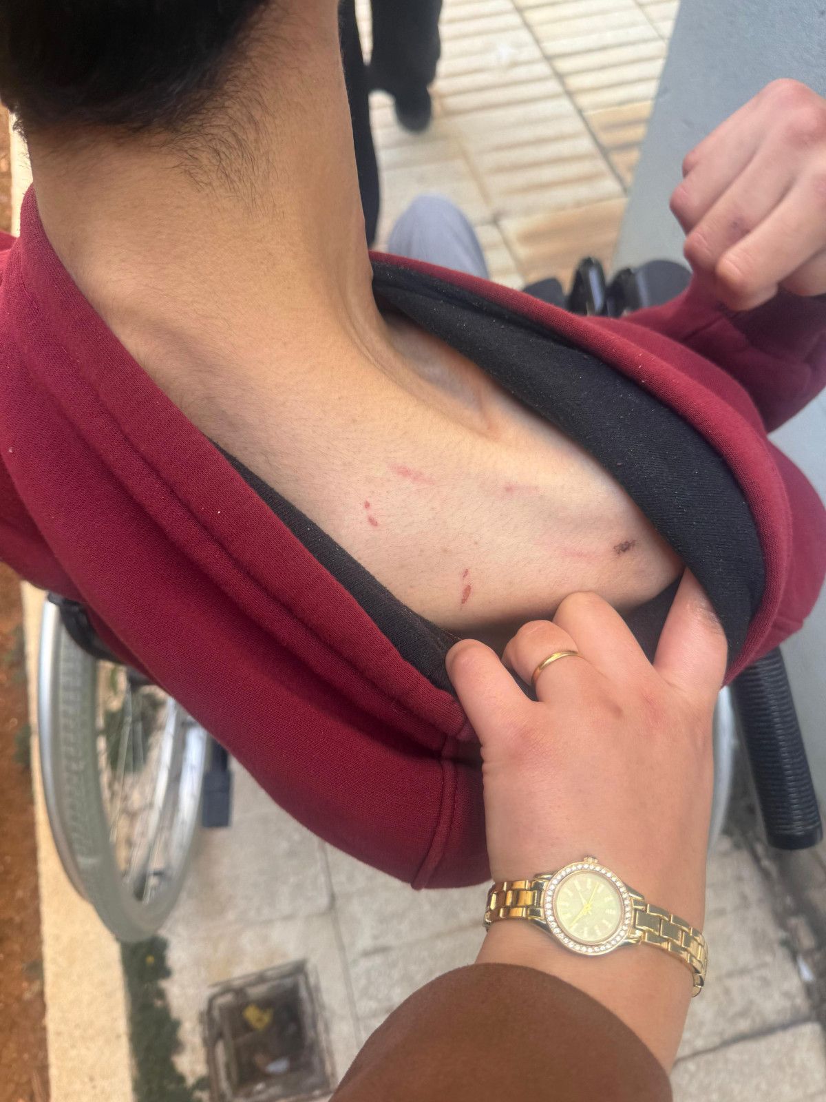 Gaziantep’te engelli bakım merkezinde şiddet: Gencin başına 6 dikiş atıldı