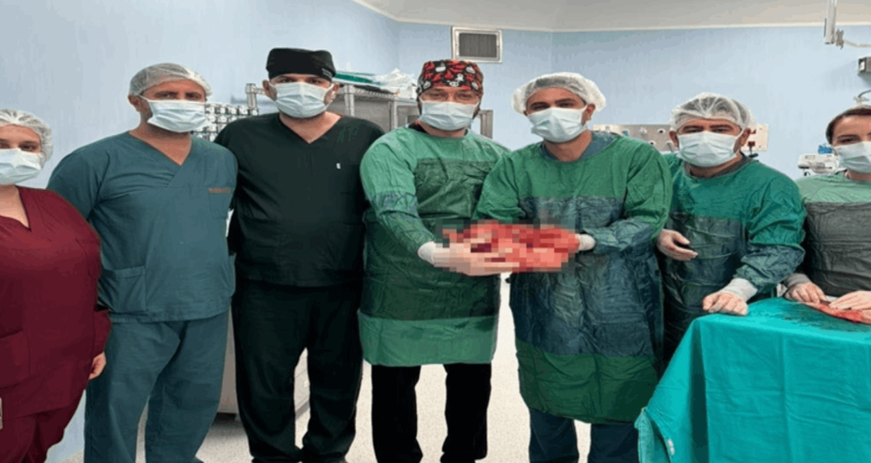 Gaziantep'te 87 Yaşındaki Kadının Karnından 4,5 Kiloluk Kitle Başarıyla Alındı