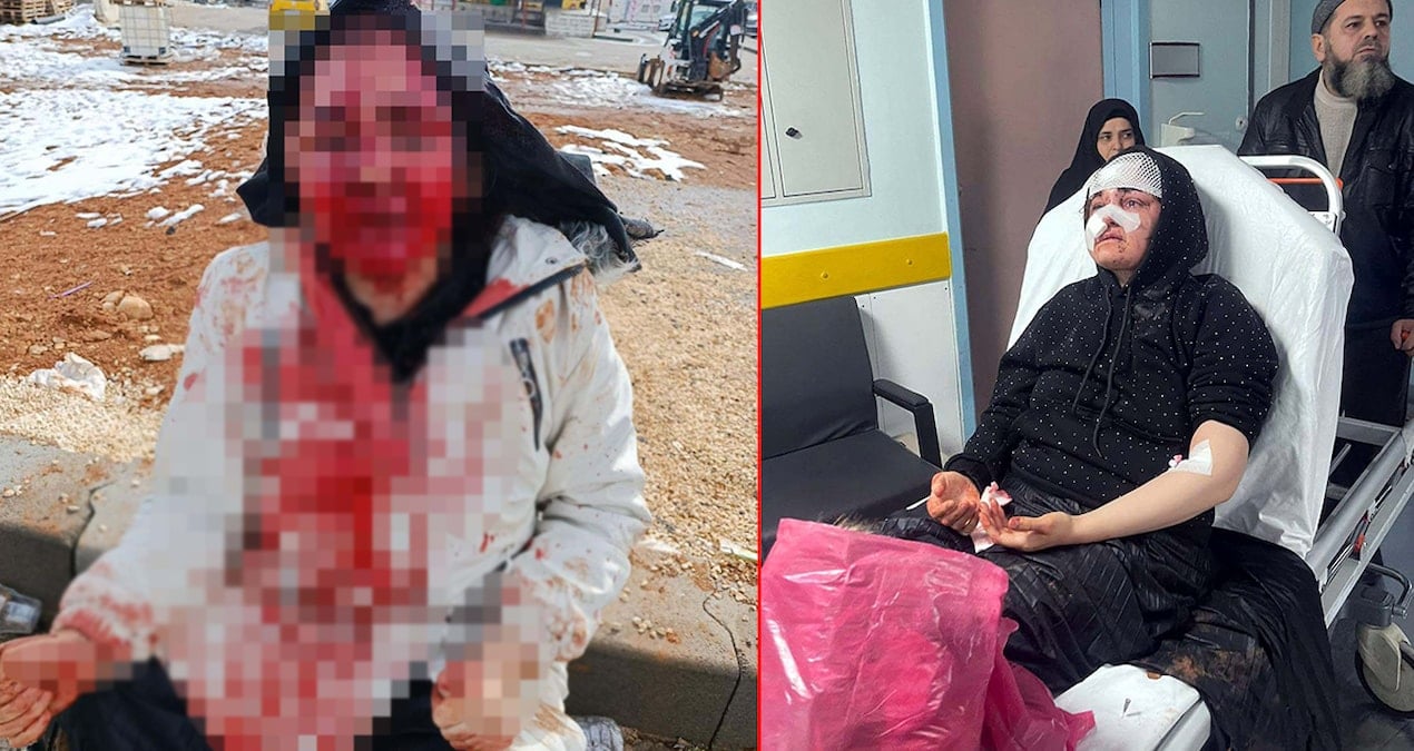 Gaziantep'te Boşanmak İsteyen Eşi Kaldırım Taşıyla Yaralayan Adam Gözaltına Alındı