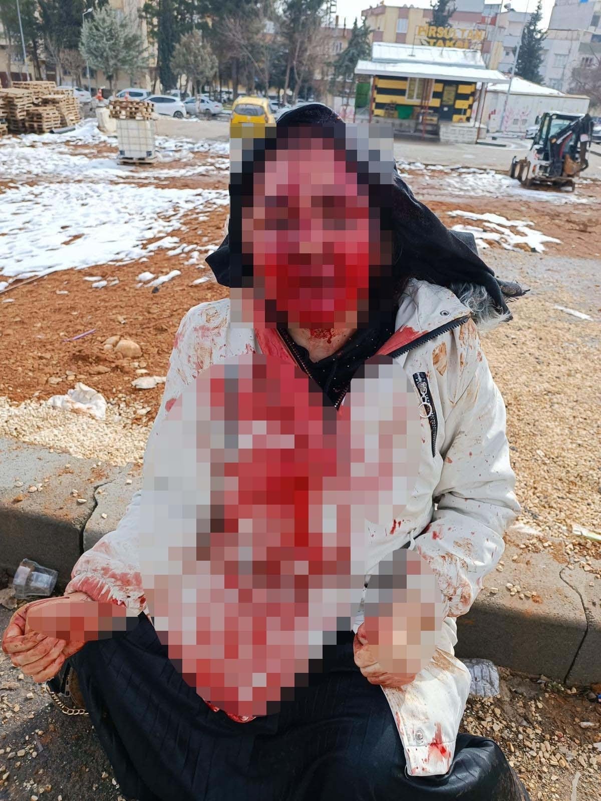 Gaziantep'te boşanma aşamasındaki karısını kaldırım taşıyla dövdü