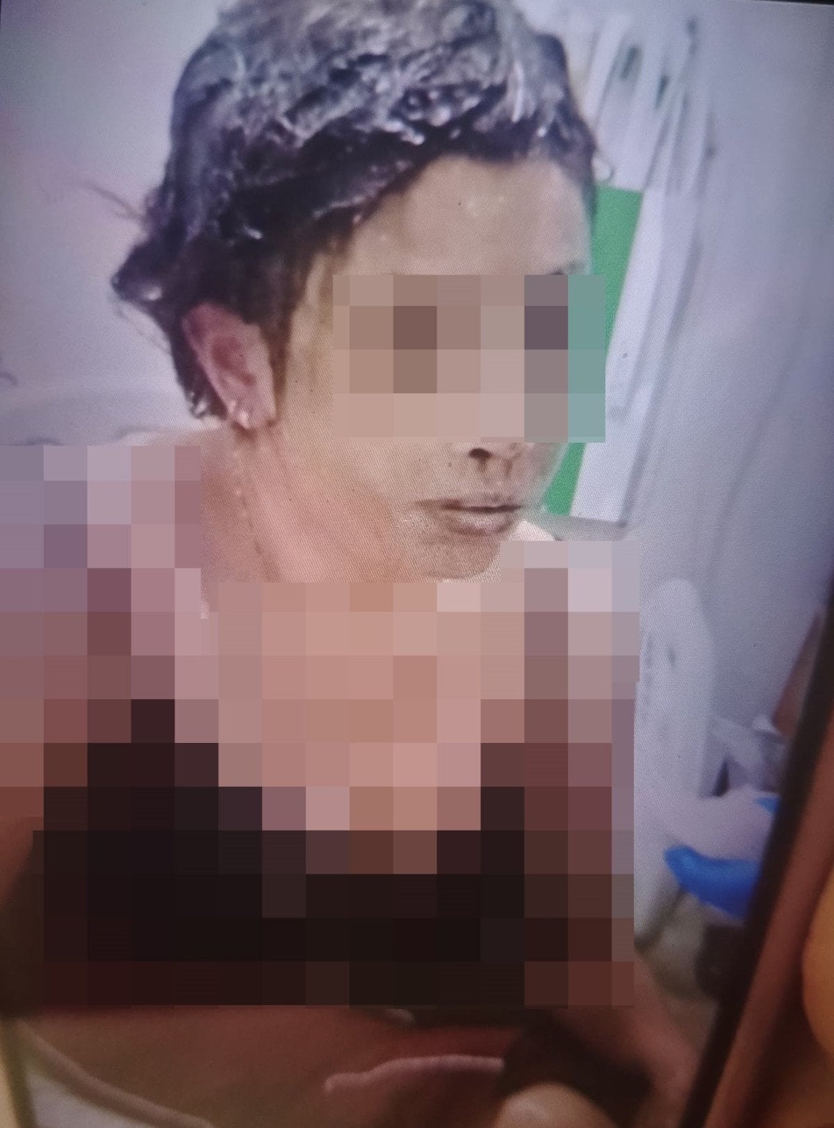 Gaziantep'te kezzapla dehşet: Şahsın kaçtığı anlar kamerada