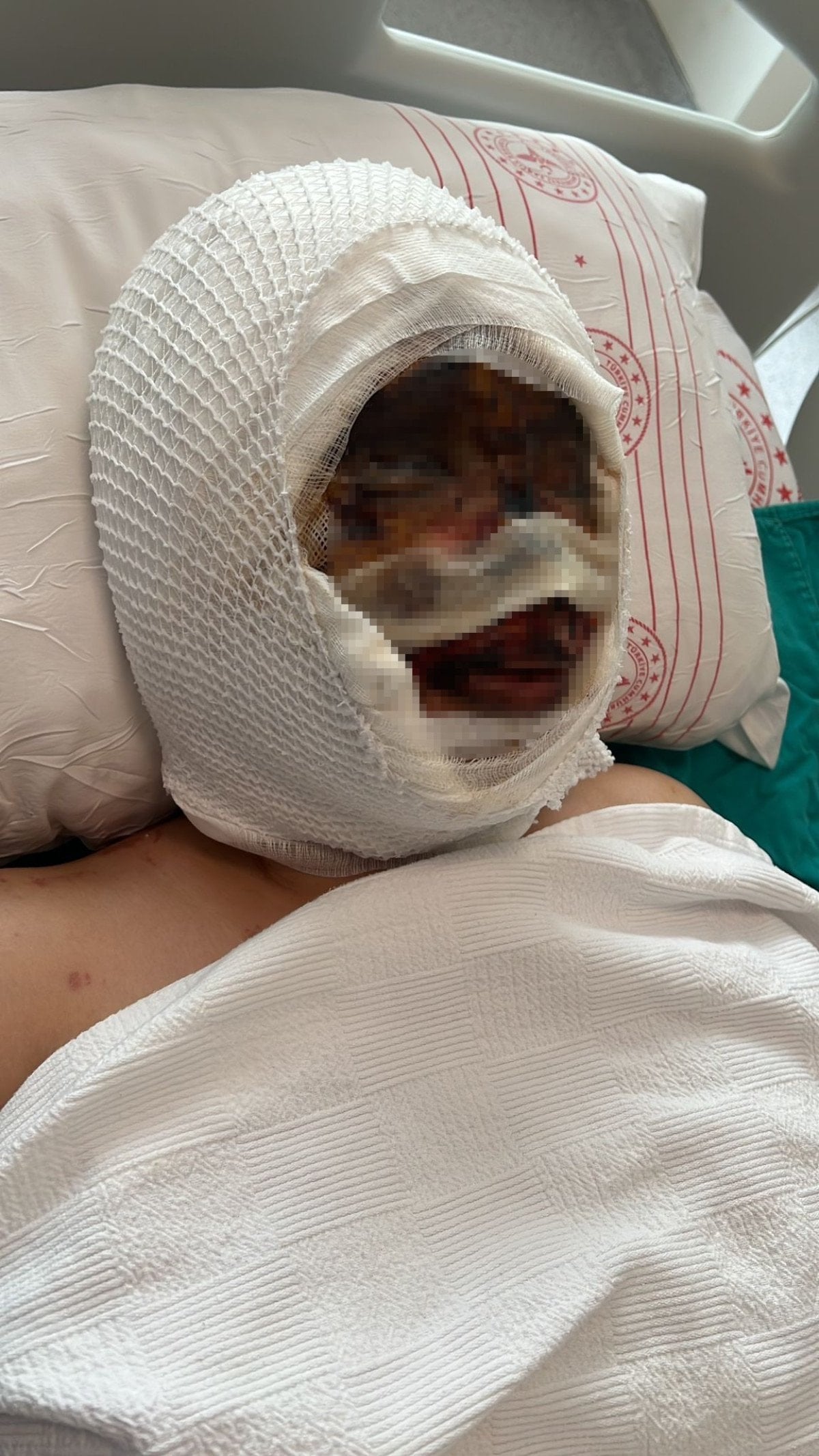 Gaziantep'te kezzapla dehşet: Şahsın kaçtığı anlar kamerada