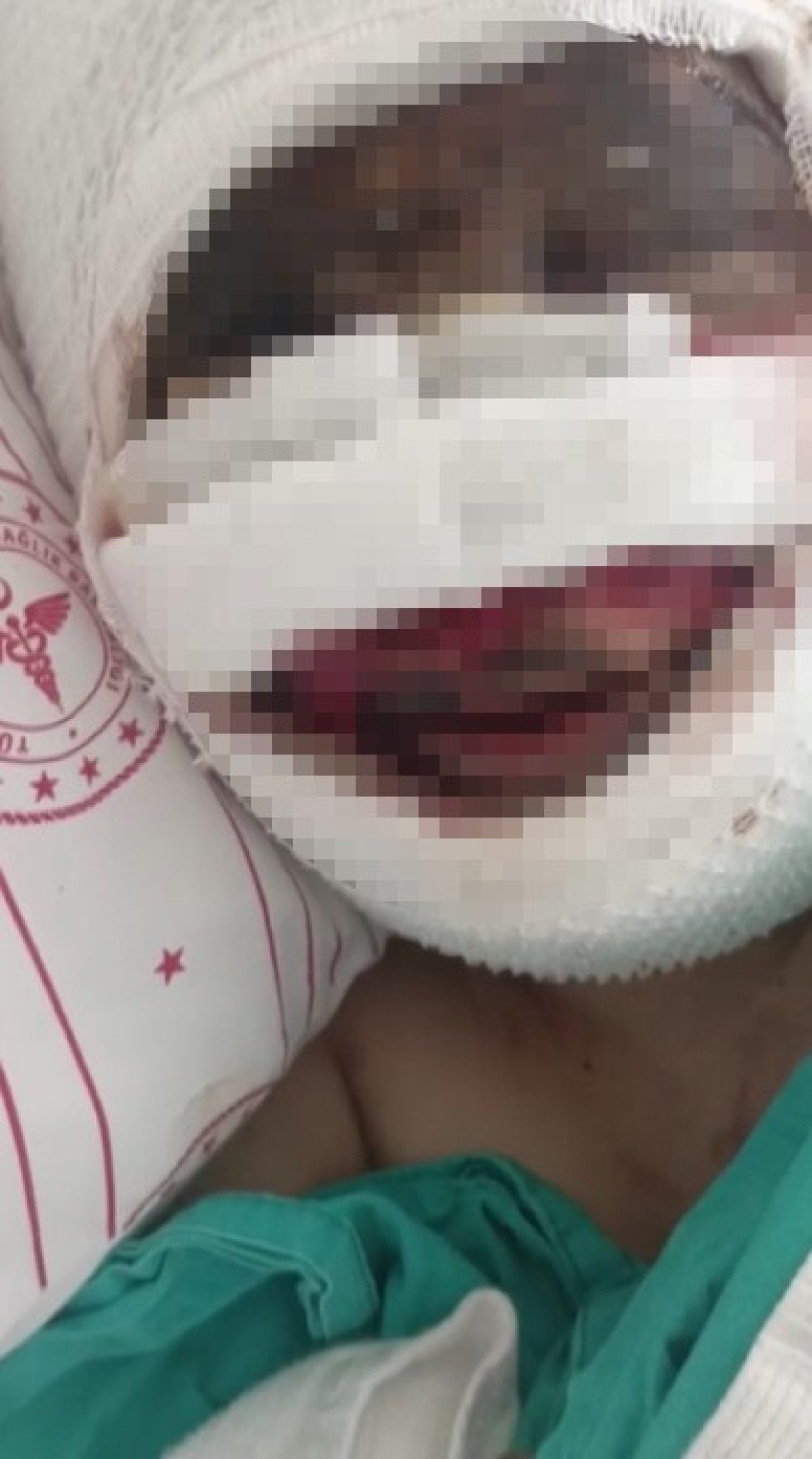 Gaziantep'te kezzapla dehşet: Şahsın kaçtığı anlar kamerada