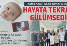 bebek tümörü - Bebek Tümörü: Gaziantep'te Mucize Başarı