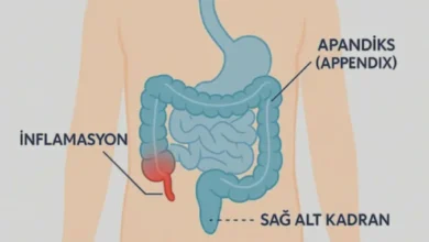 sağ karın ağrısı apandisit - Sağ Karın Ağrısı: Apandisit mi, Başka Şey mi?