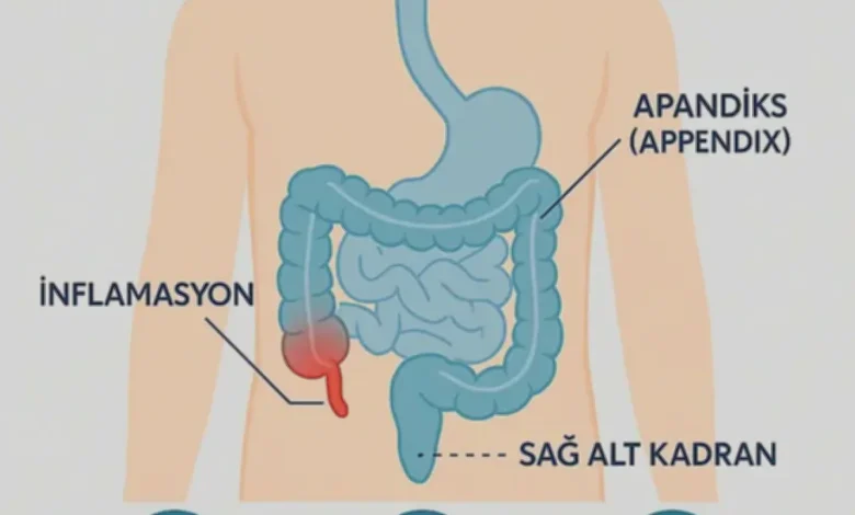 sağ karın ağrısı apandisit - Sağ Karın Ağrısı: Apandisit mi, Başka Şey mi?