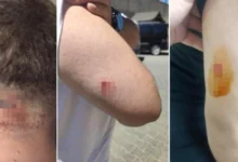 Müteahhitten Mühendise Saldırı - Müteahhitten Mühendise Saldırı: Gaziantep Şokta