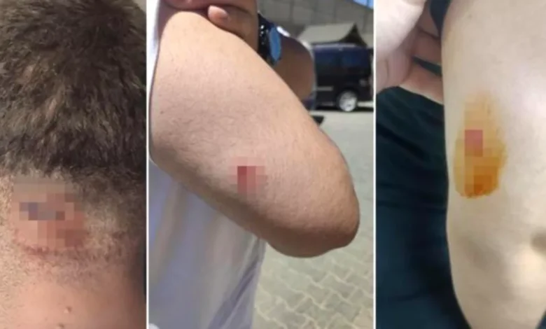 Müteahhitten Mühendise Saldırı - Müteahhitten Mühendise Saldırı: Gaziantep Şokta