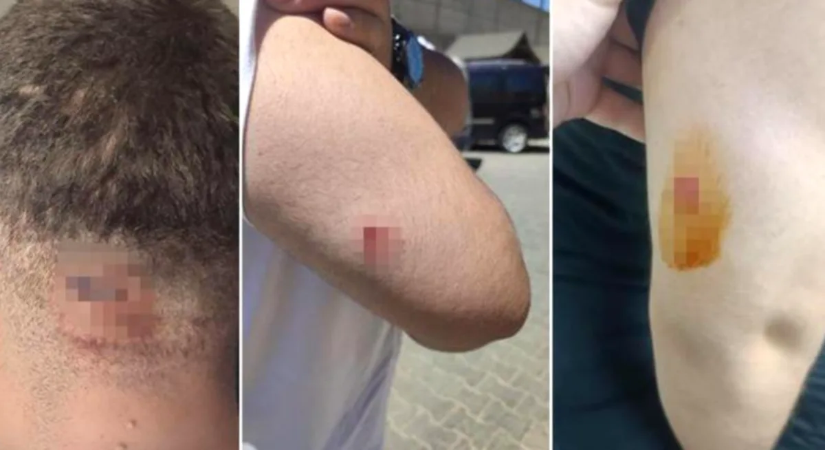 Müteahhitten Mühendise Saldırı: Gaziantep Şokta