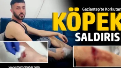 köpek saldırısı - Başarılı Köpek Saldırısı, Gaziantep'te Endişe Yarattı