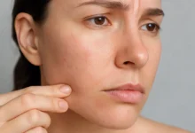 Gaziantep Cilt Doktoru - Gaziantep'te Cilt Sağlığına Yeni Umut!