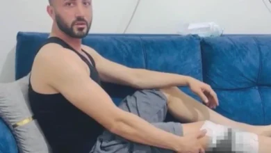 Nizip köpek saldırısı - Nizip'te Köpek Paniği: Yaralılar Tepkili