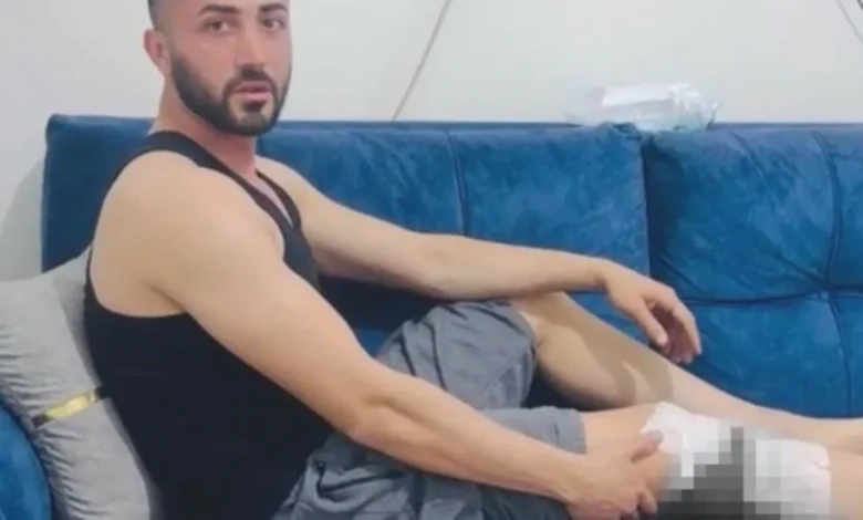 Nizip köpek saldırısı - Nizip'te Köpek Paniği: Yaralılar Tepkili