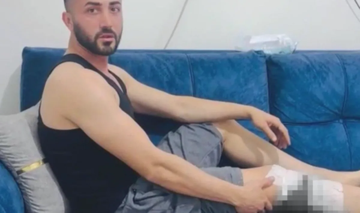 Nizip'te Köpek Paniği: Yaralılar Tepkili