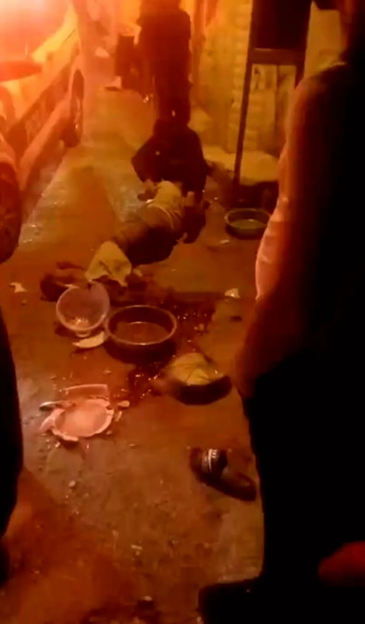 Gaziantep'te Pompalı Şoku: 1 Ağır Yaralı