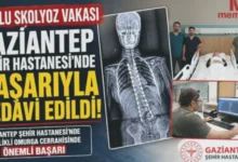 Gaziantep Omurga Mucizesi - Gaziantep Omurga Mucizesi: 13 Yaşında Yeniden Doğdu
