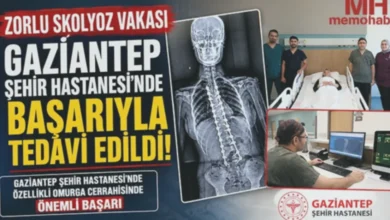 Gaziantep Omurga Mucizesi - Gaziantep Omurga Mucizesi: 13 Yaşında Yeniden Doğdu