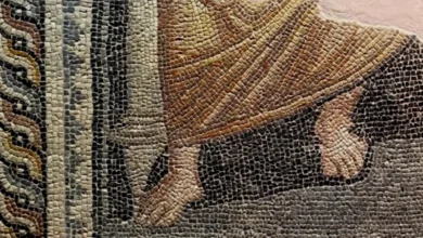 Zeugma tıbbi iz - Zeugma Mozaiğinde Tıbbi İz: Çarpık Ayak Deformitesi